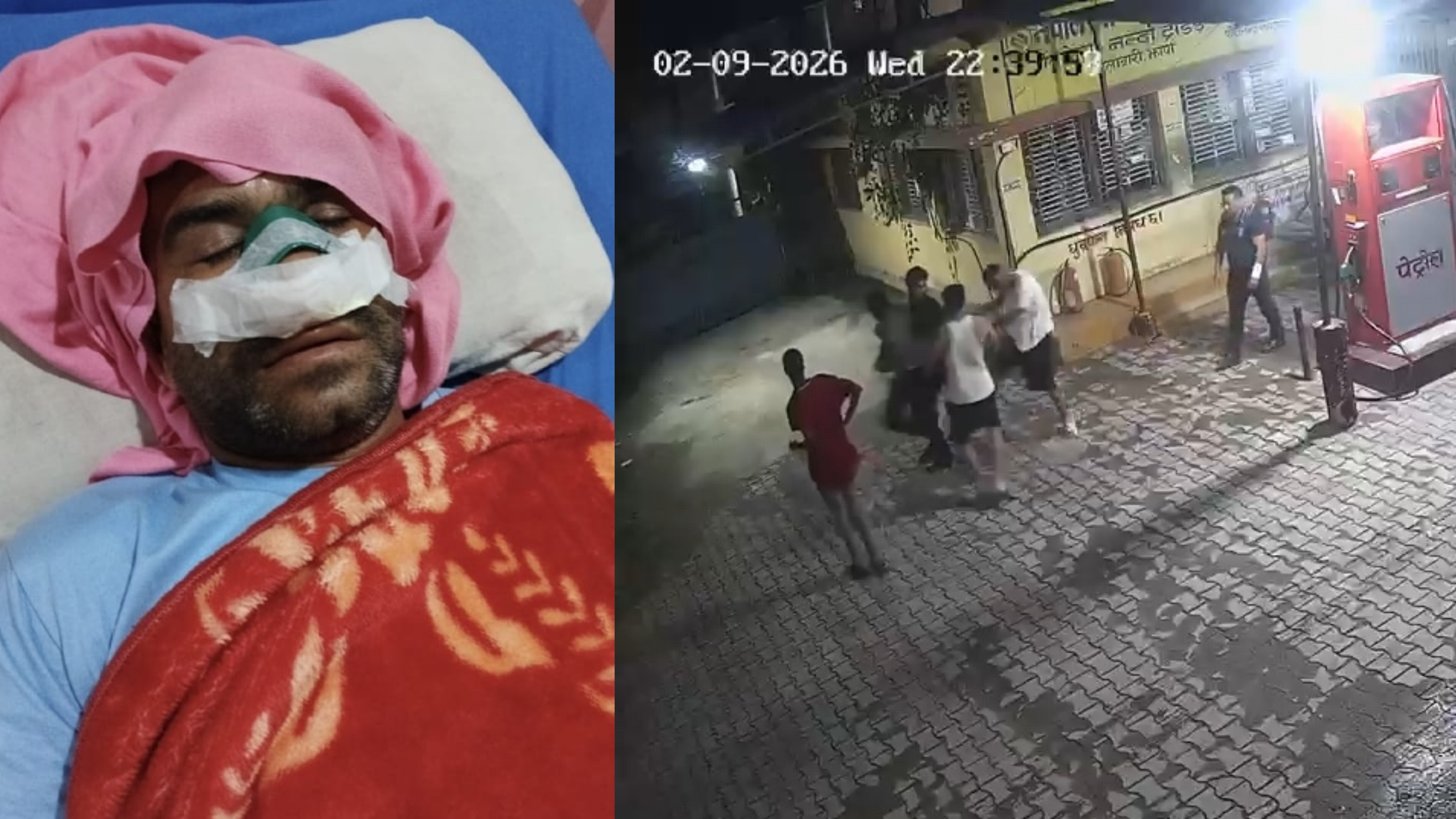 ओलीमाथी बिना कारण सांघातिक आक्रमण, दोषीलाई कानूनी कार्वाही गर्न पीडितको माग